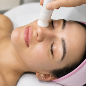 Tratamiento Rejuvenecedor Peeling Mesoterapia