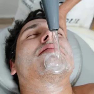 Facial Acné y/o Rosácea Jóvenes